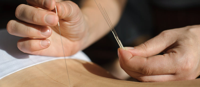 Akupunktur - Hilfe bei Wechselbeschwerden?